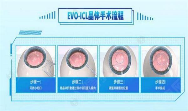 杭州十大眼科医院排名榜，评选2024年杭州白内障手术技术水平高的眼科诊所
